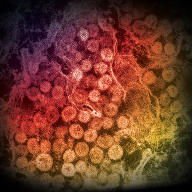 An electron micrograph of a thin section of MERS-CoV