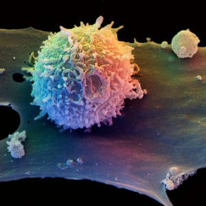 Modifying T cells could lead to an effective brain cancer therapy.