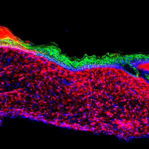 The first proof of principle for the successful regeneration of a functional organ inside an organism (the skin, the largest organ of our body) by in vivo reprogramming.