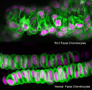 Facial cartilage cells in normal and ric1 mutant zebrafish embryos. The cell membrane and nuclei were dyed green and magenta, respectively.