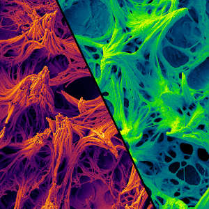 Normal ciliated epithelium coloured in orange/red and NEK10 mutant epithelium in blue/green.