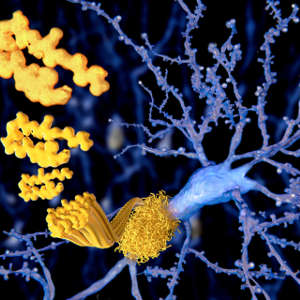 The researchers succeeded in inhibiting the aggregation of amyloid-beta peptides (pictured), a hallmark of Alzheimer’s disease.