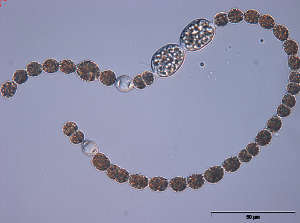 بكتيريا زرقاء من جنس الأنابينة (Anabaena) من بحيرة ستيشلين، ألمانيا