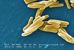 
Mycobacterium tuberculosis bacteria as seen using a colorized scanning electron micrograph (SEM).
