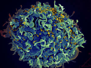 This human T cell (blue) is under attack by HIV (yellow), the virus that causes AIDS. The virus specifically targets T cells, which play a critical role in the body's immune response against invaders like bacteria and viruses.