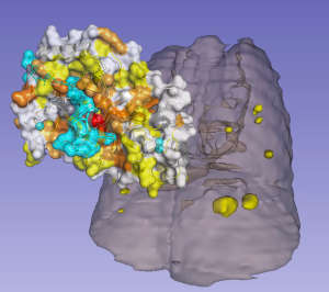 Surface representation of the mutant NSD3 enzyme bound to a histone super-imposed above a micro-CT scan showing tumours in a mouse lung.
