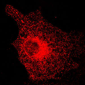 Cultured cells expressing an endoplasmic reticulum-specific red fluorescent protein, revealing the effects of EXT1 knockdown on the structure of this organelle.