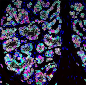 The researchers used immunofluorescence techniques to select breast epithelial cells for the unbiased assessment of DNA damage.