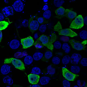 A variant of the ERG protein (green) and cell nuclei (blue) present in some lymphoedema patients. In healthy individuals, the protein exists only inside the nuclei of cells.