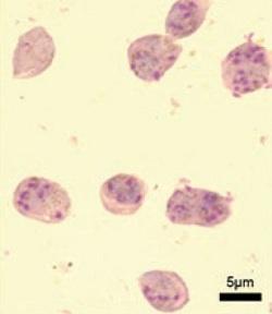 
Plasmodium berghei 
