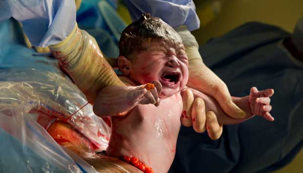 يمكن أن يتعرض أطفال الولادات القيصرية إلى مسحة من سوائل الأم المهبلية.