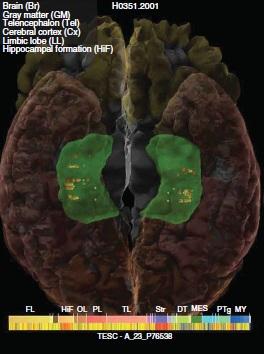 
TESC  has moderate to high gene expression throughout the adult human hippocampus (shown in green)
