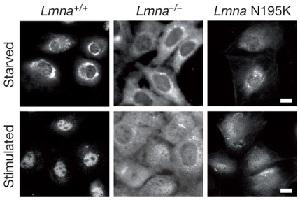 
Mice cells lacking lamins or with mutant lamins had a lower fraction of nuclear MKL1 after serum stimulation than normal cells.
