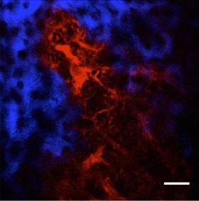 
Images of the oxygen-sensitive phosphorescent dye in bone marrow.
