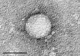 
Electron micrographs of hepatitis C virus.
