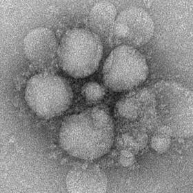 MERS-CoV particles as seen by negative stain electron microscopy.