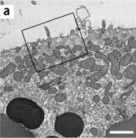 Epithelial cells with  CCNO  mutation show a reduced number of extending cilia.