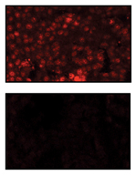 BAD phosphorylation