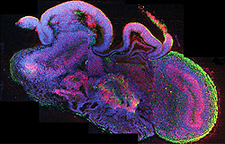 オルガノイド全体の断面図。細胞は青色、神経幹細胞は赤色、ニューロンは緑色で示されている。