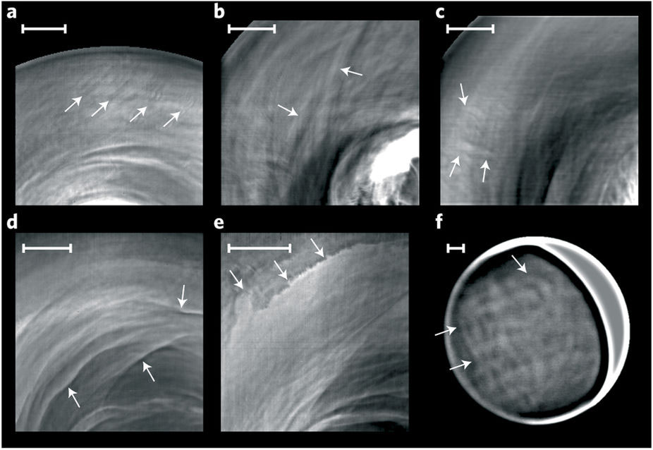 金星の夜側の高層雲に見られる定常波とゆっくりした動きの特徴