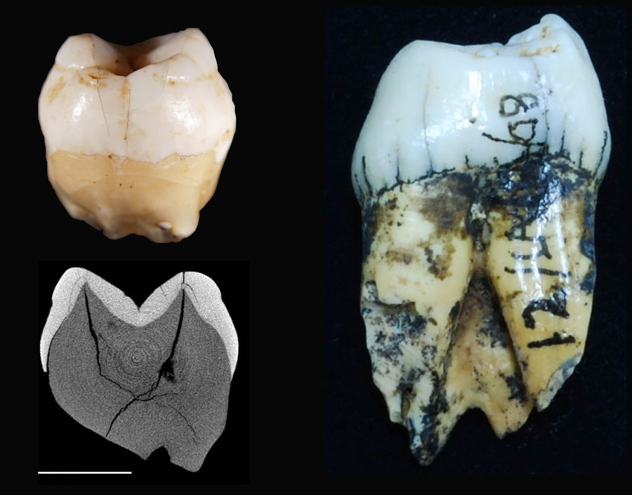 スマトラ島のLida Ajer遺跡から出土した現生人類の歯（左上）およびそのスキャン画像（左下）。右は比較用のオランウータンの歯。