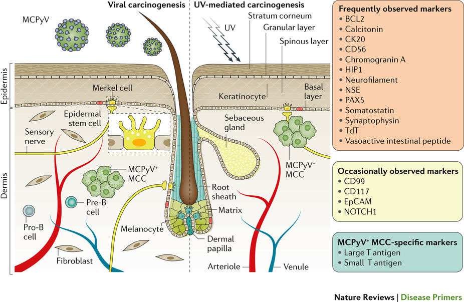 メルケル細胞がん Nature Reviews Disease Primers Nature Portfolio