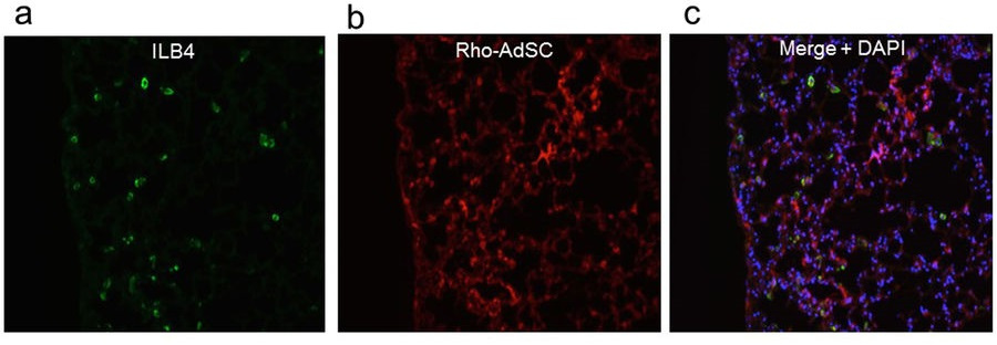 ブレイオマイシン誘発間質性肺炎マウスモデルにおける脂肪由来幹細胞静脈内投与による抗炎症性作用と抗繊維化作用