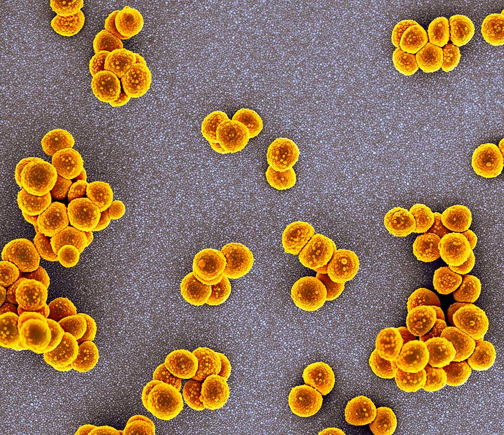 メチシリン耐性黄色ブドウ球菌（MRSA）の走査顕微鏡写真。