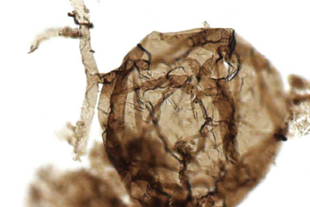 <i>Ourasphaira giraldae</i>の微化石の顕微鏡写真。