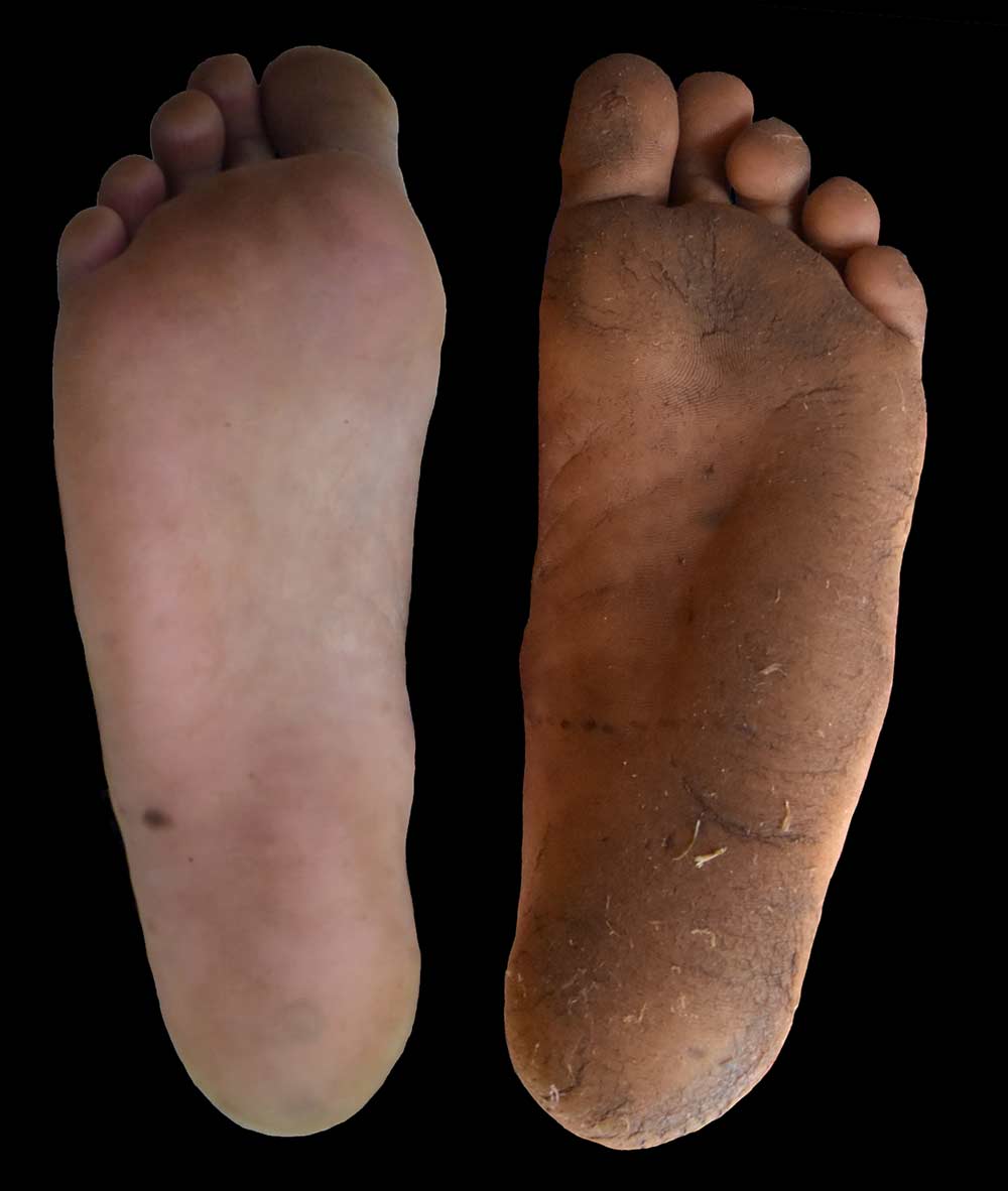 普段靴を履いている人の足（左）と裸足で歩いている人の足（右）。