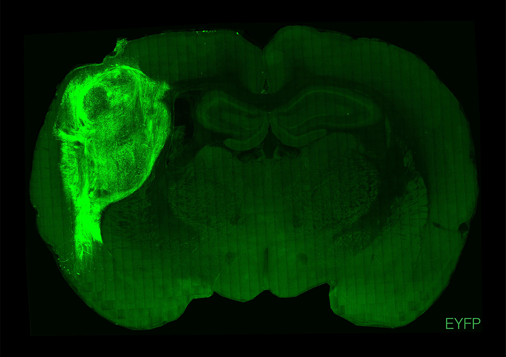 ヒト皮質オルガノイドを移植したラット脳。蛍光標識された部分がヒトオルガノイド。