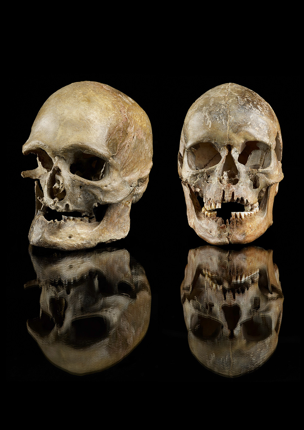 約1万4000年前に現在のドイツ西部で埋葬された男女の頭蓋骨。ゲノム解析から、これらの個体は南部から移動してきたことが分かった。