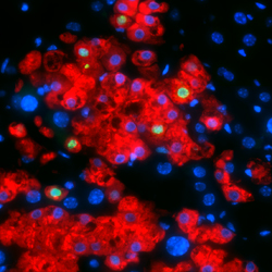 マウス初代培養肝細胞のヒトアルブミン（赤色）とKi67（緑色）の蛍光染色画像。マウス肝臓に移植したヒト繊維芽細胞由来の肝細胞が、移植後も機能し、増殖していることが分かる。