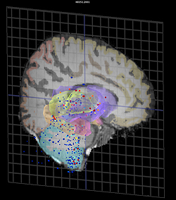 「アレン・ヒト脳アトラス」の3D画像の一例。