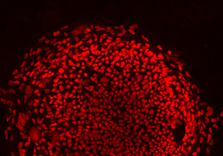 体細胞核移植によって作製したヒト胚性幹細胞。赤色は、初期胚で発現するマーカー（OCT-4）である。