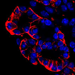マウス胚性幹細胞から分化させた甲状腺濾胞細胞で発現したヨウ素トランスポーター（赤色に染色）。