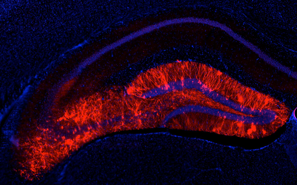 マウス海馬の断面図。赤色に光っている部分が快記憶に関連する細胞群。