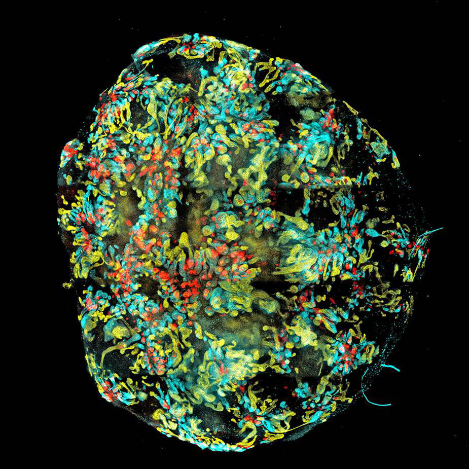 腎臓オルガノイドのスキャン画像。