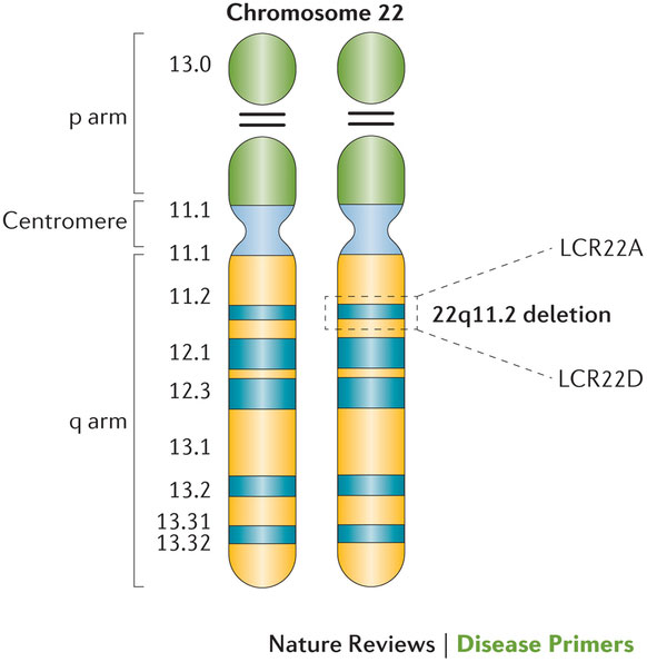 22q11.2欠失症候群