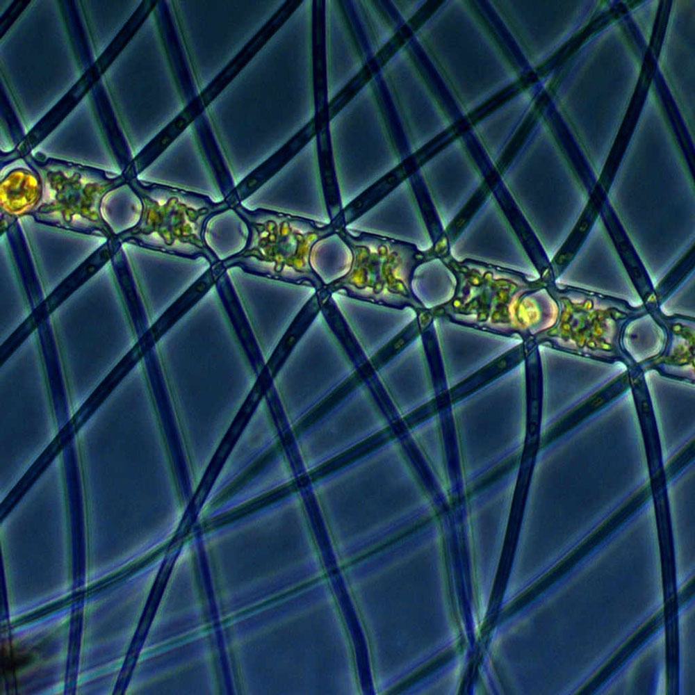 珪藻類の一種Chaetoceros atlanticus。