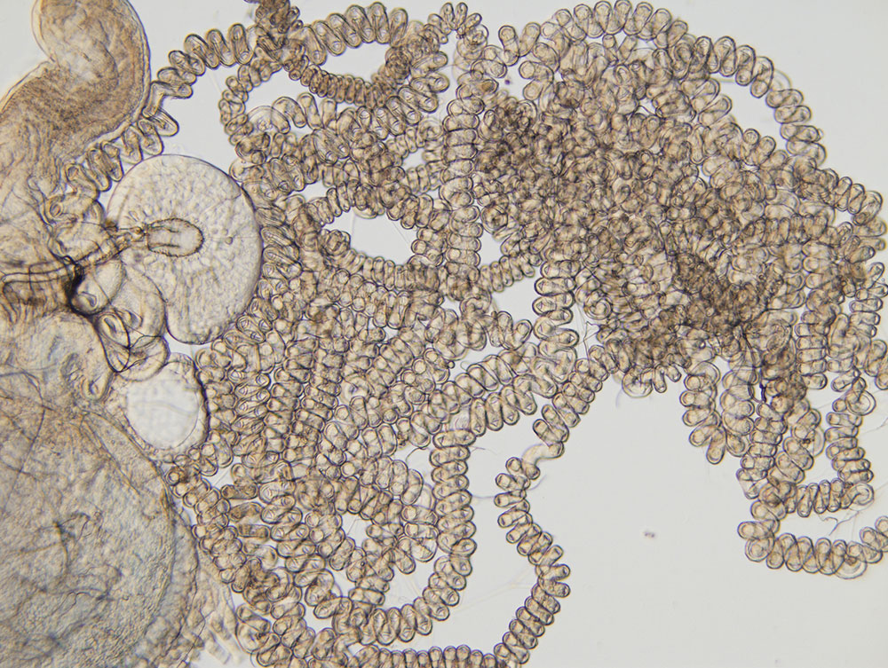 ショウジョウバエの一種（<i>Drosophila bifurca</i>）の雌が持つ、長さが8 cm近くもあるらせん状の受精嚢。