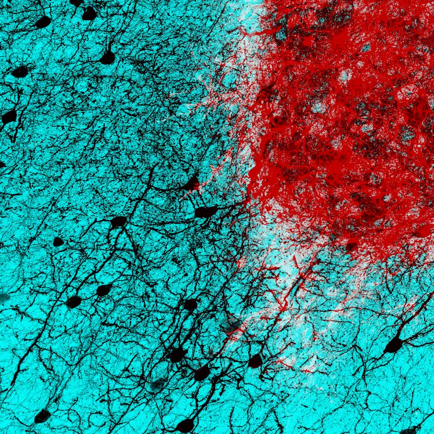 成体マウスの脳に移植された胎仔ニューロン（赤色）が、成体のニューロン（黒色）と接続してホストの神経ネットワークに組み込まれる様子。