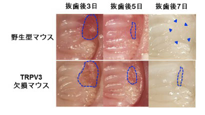 口腔粘膜上皮がもつ「温度を感知するチャネル」が、 口内の傷を早く治していた！