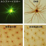 シナプスの生後発達、脳の部位によって異なることを発見！