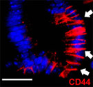 がん幹細胞マーカーCD44が、抗酸化ストレスの機能を果たしていることを発見！
