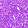 遺伝子変異によらない発がんの仕組みを、iPS細胞を使って解明！