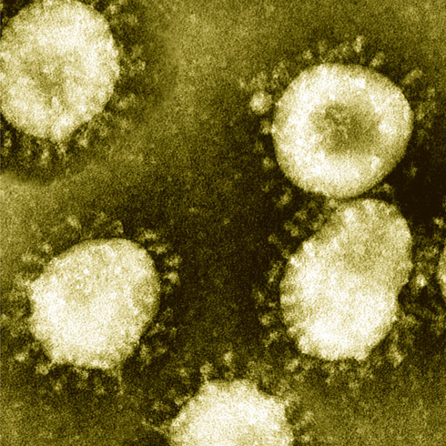 COVID-19 新型コロナウイルス