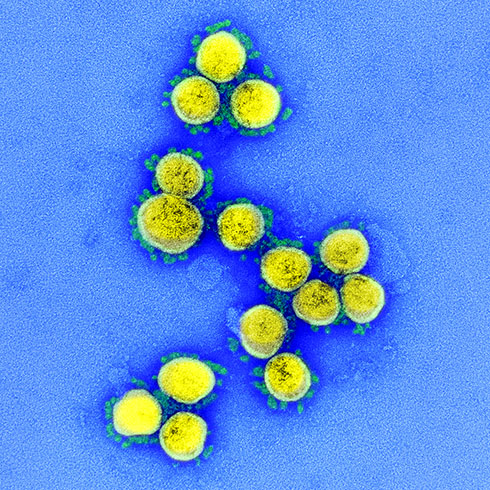 COVID-19 新型コロナウイルス