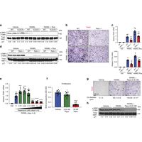 mTORC1はカルシニューリンとNFATc1を介した破骨細胞の分化を妨げる