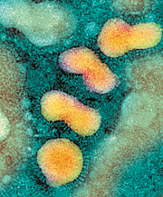 H5N1 avian influenza virus particles